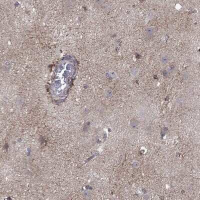 Immunohistochemistry-Paraffin: TrkB Antibody [NBP3-16988]