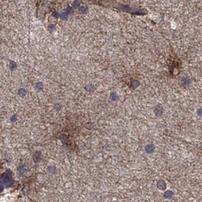 Immunohistochemistry-Paraffin: TrkB Antibody [NBP3-16988]