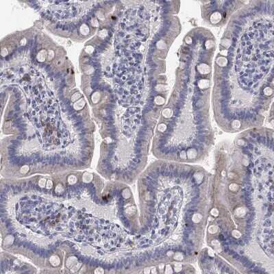 Immunohistochemistry-Paraffin: TrkB Antibody [NBP3-16988]