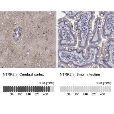 Immunohistochemistry-Paraffin: TrkB Antibody [NBP3-16988]