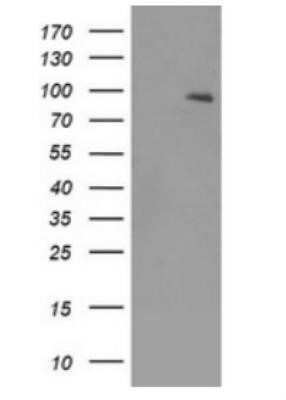 Western Blot: TrkB Antibody (OTI2E1)Azide and BSA Free [NBP2-74624]