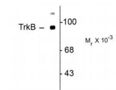 Western Blot: TrkB Antibody [NBP2-29660]