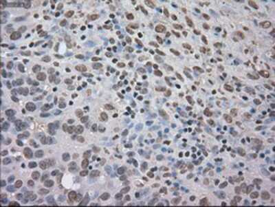Immunohistochemistry-Paraffin: TrkC Antibody (OTI2B8) [NBP1-47900]