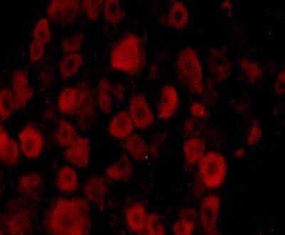 Immunocytochemistry/ Immunofluorescence: TrkC Antibody [NB100-98829]