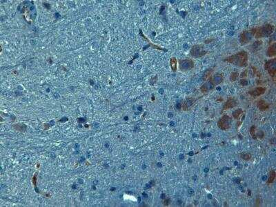 Immunohistochemistry: TrkC Antibody - BSA Free [NBP2-15185]