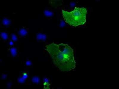 Immunocytochemistry/ Immunofluorescence: TrkC Antibody (OTI2B8) - Azide and BSA Free [NBP2-74626]
