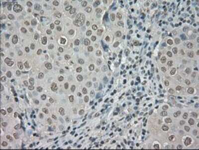 Immunohistochemistry: TrkC Antibody (OTI2B8) - Azide and BSA Free [NBP2-74626]