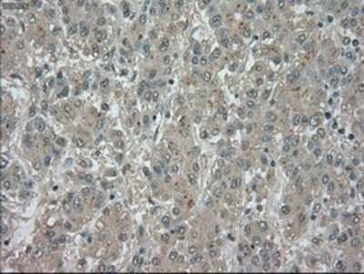 Immunohistochemistry: TrkC Antibody (OTI2B8) - Azide and BSA Free [NBP2-74626]