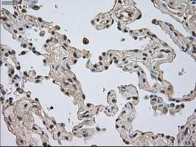 Immunohistochemistry: TrkC Antibody (OTI2B8) - Azide and BSA Free [NBP2-74626]