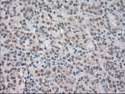 Immunohistochemistry: TrkC Antibody (OTI2B8) - Azide and BSA Free [NBP2-74626]