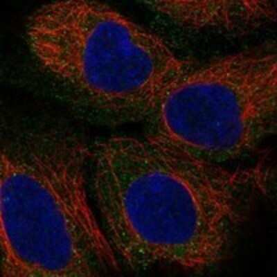 Immunocytochemistry/ Immunofluorescence: Trophinin Antibody [NBP3-17449]