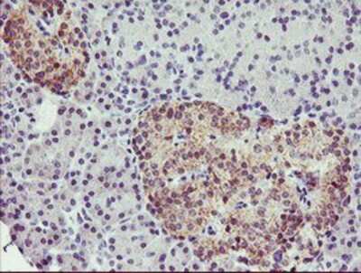 Immunohistochemistry-Paraffin: Tropomodulin 1 Antibody (OTI2C2) [NBP2-00955]
