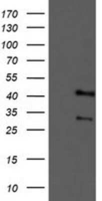 Western Blot: Tropomodulin 1 Antibody (OTI2C2) [NBP2-00955]