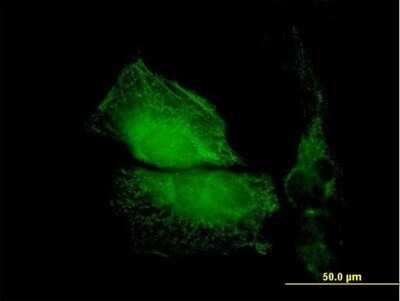 Immunocytochemistry/ Immunofluorescence: Tropomodulin 1 Antibody [H00007111-B01P]