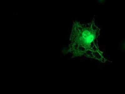 Immunocytochemistry/ Immunofluorescence: Tropomodulin 1 Antibody (OTI2C2) - Azide and BSA Free [NBP2-74632]