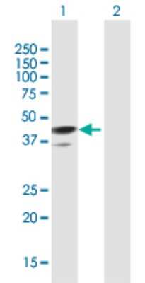 Western Blot: Tropomodulin 1 Antibody [H00007111-B01P]