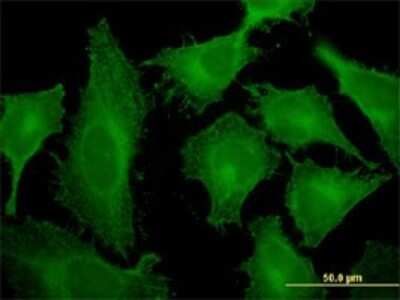 Immunocytochemistry/ Immunofluorescence: Tropomodulin 3 Antibody (1E1) [H00029766-M10]