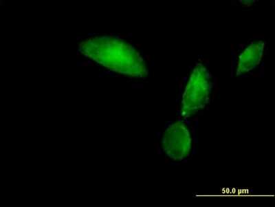 Immunocytochemistry/ Immunofluorescence: Tropomodulin 3 Antibody [H00029766-B01P]