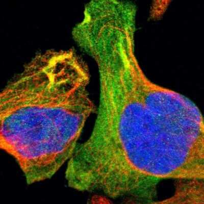Immunocytochemistry/ Immunofluorescence: Tropomodulin 3 Antibody [NBP1-86870]