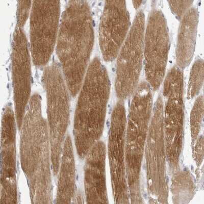 Immunohistochemistry-Paraffin: Tropomodulin 4 Antibody [NBP1-80745]