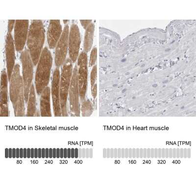 Immunohistochemistry-Paraffin: Tropomodulin 4 Antibody [NBP1-80745]