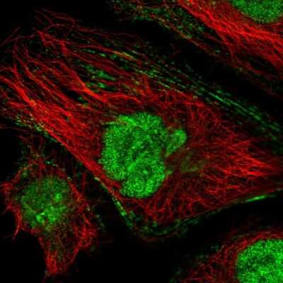 Immunocytochemistry/ Immunofluorescence: Troponin C (cardiac) Antibody [NBP2-55151]