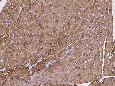Immunohistochemistry-Paraffin: Troponin C (cardiac) Antibody [NBP2-97146]