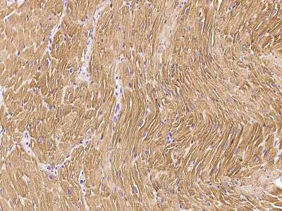 Immunohistochemistry-Paraffin: Troponin C (cardiac) Antibody [NBP2-99393]