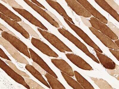 Immunohistochemistry-Paraffin: Troponin C (cardiac) Antibody [NBP2-99435]