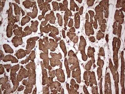 Immunohistochemistry: Troponin C (cardiac) Antibody (OTI5H3) - Azide and BSA Free [NBP2-74638]