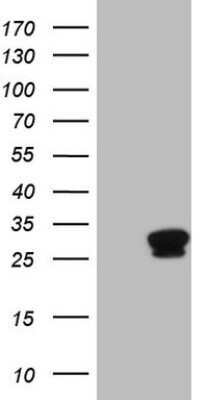 Western Blot: Troponin I Type 1 (slow skeletal) Antibody (OTI8H8) [NBP2-46170]