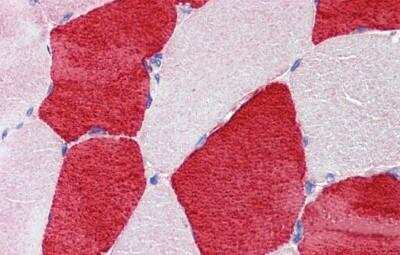 Immunohistochemistry-Paraffin: Troponin I Type 1 (slow skeletal) Antibody [NBP1-56641]