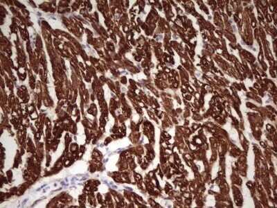 Immunohistochemistry: Troponin I Type 1 (slow skeletal) Antibody (OTI8H8) - Azide and BSA Free [NBP2-74639]