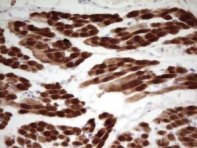 Immunohistochemistry: Troponin I Type 1 (slow skeletal) Antibody (OTI8H8) - Azide and BSA Free [NBP2-74639]