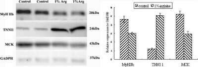 Western Blot: Troponin I Type 1 (slow skeletal) Antibody [NBP1-56641]