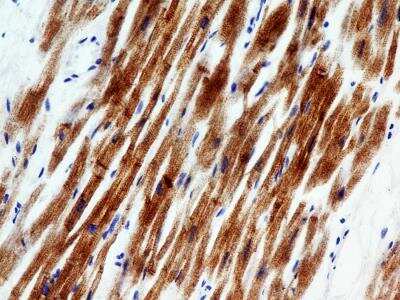 Immunohistochemistry-Paraffin: Troponin I Type 3 (cardiac) Antibody (1E10) - BSA Free [NBP2-35337]