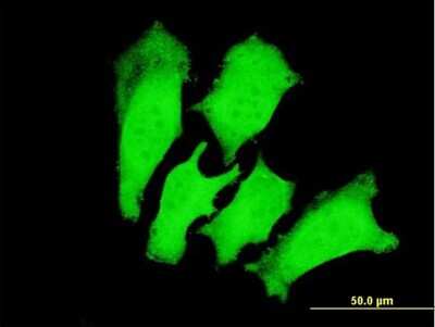Immunocytochemistry/ Immunofluorescence: Troponin I Type 3 (cardiac) Antibody (1E7) [H00007137-M04]