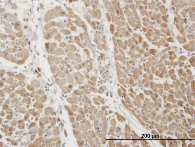 Immunohistochemistry-Paraffin: Troponin I Type 3 (cardiac) Antibody (1E7) [H00007137-M04]