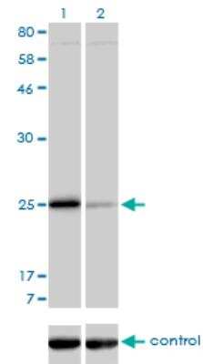 Western Blot: Troponin I Type 3 (cardiac) Antibody (1E7) [H00007137-M04]