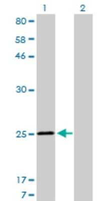 Western Blot: Troponin I Type 3 (cardiac) Antibody (1E7) [H00007137-M04]