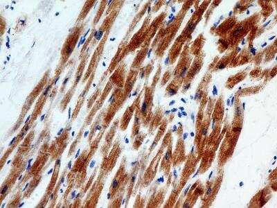 Immunohistochemistry-Paraffin: Troponin I Type 3 (cardiac) Antibody (2C9) - BSA Free [NBP2-35336]