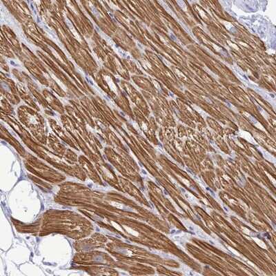 Immunohistochemistry: Troponin I Type 3 (cardiac) Antibody [NBP2-33463]