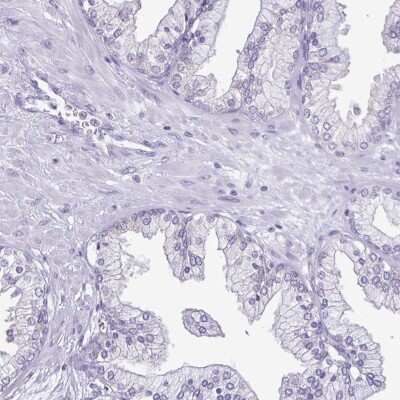 Immunohistochemistry-Paraffin: Troponin I Type 3 (cardiac) Antibody [NBP2-33463]