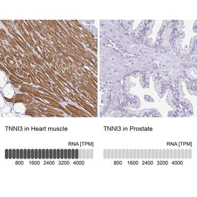 Immunohistochemistry-Paraffin: Troponin I Type 3 (cardiac) Antibody [NBP2-33463]