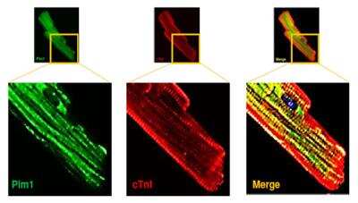 Immunofluorescence: Troponin I Type 3 (cardiac) [p Ser150] Antibody [NBP2-29526]