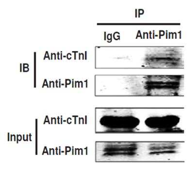 Immunoprecipitation: Troponin I Type 3 (cardiac) [p Ser150] Antibody [NBP2-29526]
