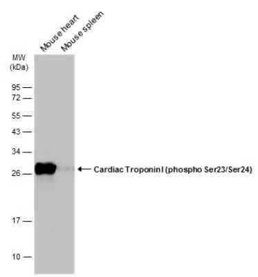 Western Blot: Troponin I Type 3 (cardiac) [p Ser24, p Ser23] Antibody [NBP3-13325]