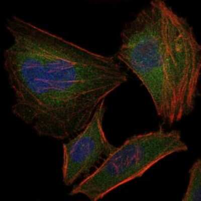 Immunocytochemistry/ Immunofluorescence: Troponin I type 2 (fast skeletal) Antibody (2F12G2) - BSA Free [NBP2-37536]