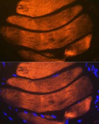 Immunohistochemistry: Troponin I type 2 (fast skeletal) Antibody (2H7S10) [NBP3-16474]