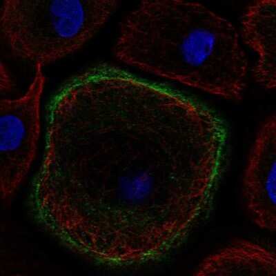 Immunocytochemistry/ Immunofluorescence: Troponin I type 2 (fast skeletal) Antibody [NBP2-38775]